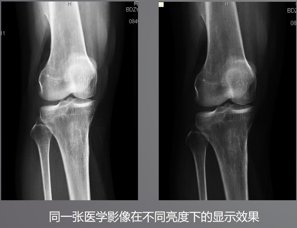 寵物DR設(shè)備的顯示器有要求？普通和醫(yī)用顯示器有什么區(qū)別