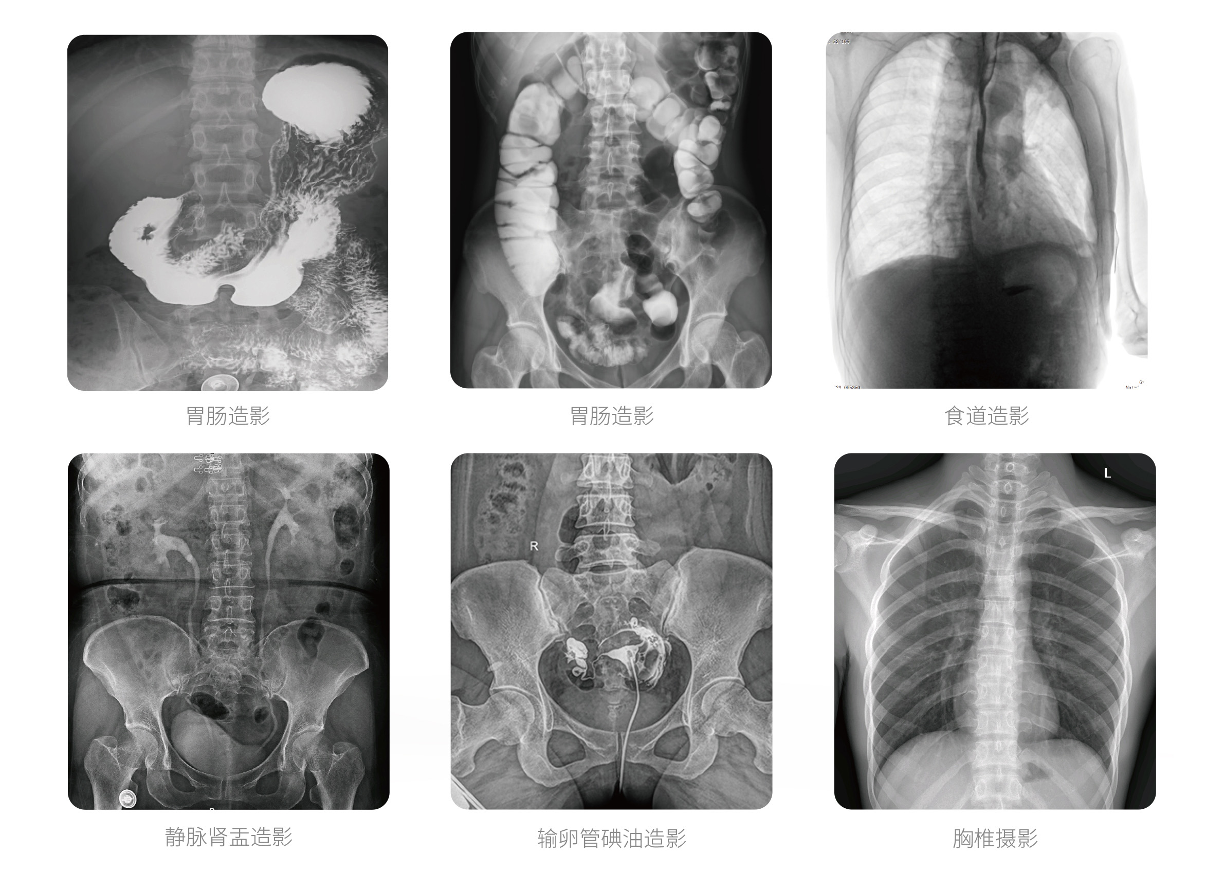 PLX8500E動態(tài)U臂DR臨床影像